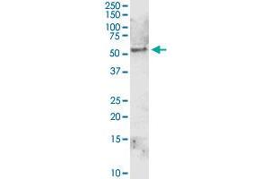 ALDH1A1 MaxPab rabbit polyclonal antibody. (ALDH1A1 antibody  (AA 1-501))