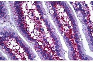 Human Intestine: Formalin-Fixed, Paraffin-Embedded (FFPE) (COL6A1 antibody  (AA 191-240))