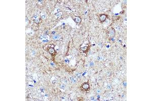 Immunohistochemistry of paraffin-embedded Mouse spinal cord using WWC1 Rabbit pAb (ABIN7271388) at dilution of 1:100 (40x lens). (WWC1 antibody  (AA 950-1050))