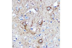 Immunohistochemistry of paraffin-embedded Mouse spinal cord using WWC1 Rabbit pAb (ABIN7271388) at dilution of 1:100 (40x lens).