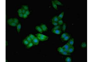 Immunofluorescent analysis of HepG2 cells using ABIN7144136 at dilution of 1:100 and Alexa Fluor 488-congugated AffiniPure Goat Anti-Rabbit IgG(H+L) (AGT antibody  (AA 44-427))