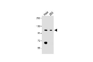 All lanes : Anti-LONP1 Antibody (Center) at 1:2000 dilution Lane 1: Hela whole cell lysate Lane 2: 293 whole cell lysate Lysates/proteins at 20 μg per lane. (LONP1 antibody  (AA 389-418))