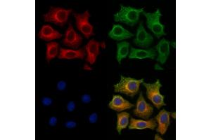 ABIN7094363 and ABIN7098410 staining HepG2 cells by IF/ICC. (STARD3 antibody  (Internal Region))