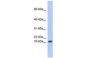 Image no. 1 for anti-Ribosomal Protein L30 (RPL30) (AA 35-84) antibody (ABIN6743983) (RPL30 antibody  (AA 35-84))