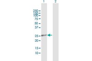 Western Blot analysis of DCI expression in transfected 293T cell line by DCI MaxPab polyclonal antibody.