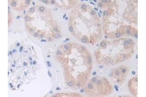 DAB staining on IHC-P; Samples: Human Kidney Tissue (ADAM9 antibody  (AA 440-680))