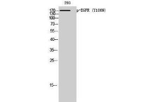 Western Blotting (WB) image for anti-Epidermal Growth Factor Receptor (EGFR) (pTyr1069) antibody (ABIN3179543) (EGFR antibody  (pTyr1069))