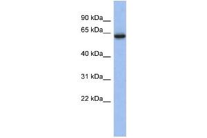 WB Suggested Anti-CACNB2 Antibody Titration:  0. (CACNB2 antibody  (Middle Region))