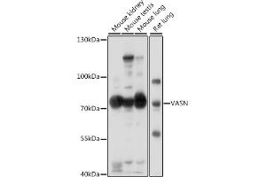 Western blot analysis of extracts of various cell lines, using VASN antibody (ABIN7271301) at 1:1000 dilution. (Vasn antibody  (AA 420-575))