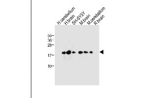 All lanes : Anti-FXYD6 Antibody (C-term) at 1:1000 dilution Lane 1: Human cerebellum tissue lysate Lane 2: Human brain tissue lysate Lane 3: SH-SY5Y whole cell lysate Lane 4: Mouse brain tissue lysate Lane 5: Mouse cerebellum tissue lysate Lane 6: Rat brain tissue lysate Lysates/proteins at 20 μg per lane. (FXYD6 antibody  (C-Term))