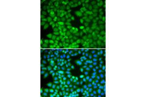Immunofluorescence analysis of MCF-7 cell using RAN antibody. (RAN antibody)