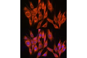 Immunofluorescence analysis of NIH-3T3 cells using PPM1A Rabbit pAb (ABIN6132507, ABIN6146039, ABIN6146040 and ABIN6222411) at dilution of 1:100 (40x lens). (PPM1A antibody  (AA 1-382))