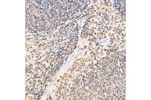 Immunohistochemistry of paraffin-embedded mouse spleen using SS18 Rabbit pAb (ABIN6133185, ABIN6148473, ABIN6148474 and ABIN6222754) at dilution of 1:100 (40x lens).