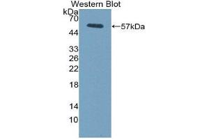 Western Blotting (WB) image for anti-Fc Fragment of IgG, Low Affinity IIIa, Receptor (CD16a) (FCGR3A) (AA 5-240) antibody (ABIN1858833) (FCGR3A antibody  (AA 5-240))