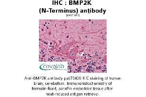 Image no. 1 for anti-BMP2 Inducible Kinase (BMP2K) (N-Term) antibody (ABIN1732361) (BMP2K antibody  (N-Term))