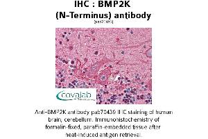 Image no. 1 for anti-BMP2 Inducible Kinase (BMP2K) (N-Term) antibody (ABIN1732361) (BMP2K antibody  (N-Term))