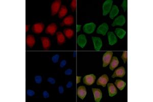 Phospho-IP3 Receptor (Ser1598) Antibody staining Hela cells(45 min of heat-shock treatment) by IF/ICC.