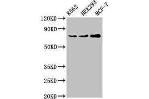 Western Blot Positive WB detected in: K562 whole cell lysate, HEK293 whole cell lysate, MCF-7 whole cell lysate All lanes: RALBP1 antibody at 4 μg/mL Secondary Goat polyclonal to rabbit IgG at 1/50000 dilution Predicted band size: 77 kDa Observed band size: 77 kDa (RALBP1 antibody  (AA 6-105))