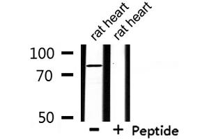 Western blot analysis of extracts from rat heart , using ZFYVE20 Antibody. (Rabenosyn 5 antibody  (Internal Region))