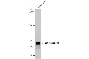 WB Image Eph receptor A4 antibody detects Eph receptor A4 protein by western blot analysis. (EPH Receptor A4 antibody)