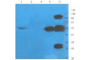 Western Blot using anti-TNFalpha antibody  Rat liver (lane 1), rat spinal cord (lane 2), mouse testis (lane 3), rat colon (lane 4) and human thyroid tumour (lane 5) samples were resolved on a 10% SDS PAGE gel and blots probed with  at 1 µg/ml before being detected by a secondary antibody. (Recombinant TNF alpha (Humicade Biosimilar) antibody)