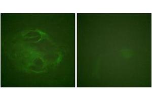 Immunofluorescence analysis of HeLa cells, using HRS (Ab-334) Antibody. (HRS (HRS) (AA 301-350) antibody)