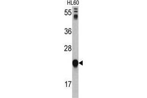 Western blot analysis of GLO1 antibody (N-term) in HL60 cell line lysates (35 µg/lane). (GLO1 antibody  (N-Term))