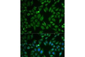 Immunofluorescence analysis of U2OS cells using SCG2 Polyclonal Antibody (SCG2 antibody)