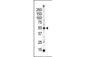 Image no. 1 for anti-Protein Kinase C and Casein Kinase Substrate in Neurons 3 (PACSIN3) (N-Term) antibody (ABIN360557) (PACSIN3 antibody  (N-Term))