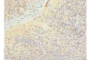 Immunohistochemistry of paraffin-embedded human tonsil tissue using ABIN7163185 at dilution of 1:100 (PIP5K1A antibody  (AA 293-562))