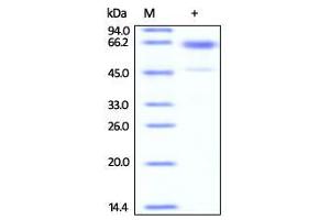 Mouse Glycophorin A, His Tag & Fc Tag on SDS-PAGE under reducing (R) condition.