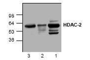 Image no. 1 for anti-Histone Deacetylase 2 (HDAC2) antibody (ABIN127234) (HDAC2 antibody)