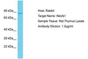 Image no. 1 for anti-NADH Dehydrogenase (Ubiquinone) Fe-S Protein 1, 75kDa (NADH-Coenzyme Q Reductase) (NDUFS1) (AA 88-137) antibody (ABIN6750362) (NDUFS1 antibody  (AA 88-137))