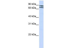 WB Suggested Anti-ZNF572 Antibody Titration:  0. (ZNF572 antibody  (N-Term))