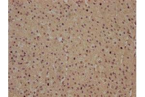 IHC image of ABIN7140118 diluted at 1:100 and staining in paraffin-embedded human adrenal gland tissue performed on a Leica BondTM system. (RHBDD3 antibody  (AA 304-323))