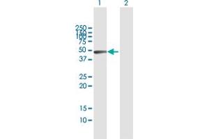 Western Blot analysis of GLA expression in transfected 293T cell line by GLA MaxPab polyclonal antibody. (GLA antibody  (AA 1-429))