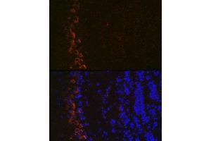 Immunofluorescence analysis of mouse brain using GluR2/GRI Rabbit mAb (ABIN7267414) at dilution of 1:100 (40x lens). (GRIA2 antibody)