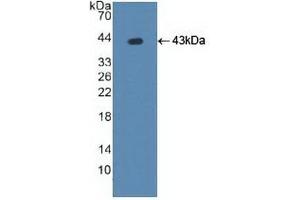Detection of Recombinant ATP7b, Human using Polyclonal Antibody to ATPase, Cu++ Transporting Beta Polypeptide (ATP7b) (ATP7B antibody  (AA 59-426))