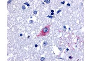Anti-LGR4 antibody IHC of human brain, neurons and glia. (LGR4 antibody  (Cytoplasmic Domain))