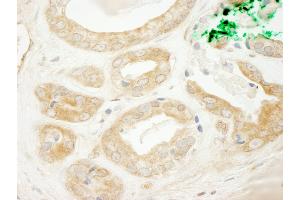 anti-ADP-Ribosylation Factor Guanine Nucleotide-Exchange Factor 2 (Brefeldin A-Inhibited) (ARFGEF2) (AA 300-350) antibody