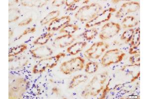 Formalin-fixed and paraffin embedded human kidney labeled with Anti-GST Polyclonal Antibody, Unconjugated  at 1:200 followed by conjugation to the secondary antibody and DAB staining (GSTP1 antibody  (AA 121-210))