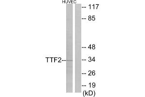 Western blot analysis of extracts from HUVEC cells, using TTF2 antibody. (TTF2 antibody  (N-Term))