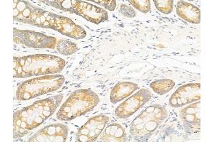 ABIN6258423 and ABIN6276238 at 1/100 staining Rat colorectal tissue by IHC-P.