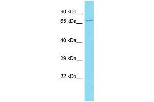 Host: Rabbit Target Name: CCDC120 Sample Type: Hela Whole cell lysates Antibody Dilution: 1. (CCDC120 antibody  (C-Term))