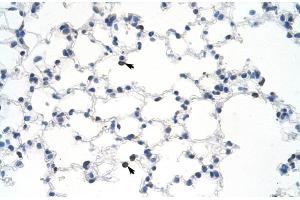 Immunohistochemistry (IHC) image for anti-Myb-Binding Protein 1A (MYBBP1A) (C-Term) antibody (ABIN2780004)
