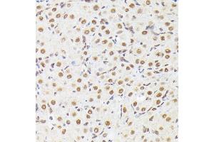 Immunohistochemistry of paraffin-embedded mouse spinal cord using XRCC2 Rabbit pAb  at dilution of 1:50 (40x lens). (XRCC2 antibody)