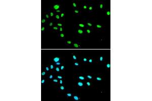 Immunofluorescence (IF) image for anti-RuvB-Like 1 (E. Coli) (RUVBL1) (AA 1-240) antibody (ABIN6147319)