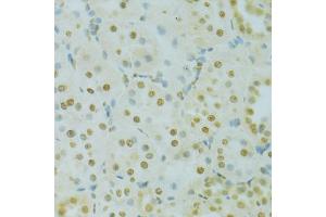 Immunohistochemistry of paraffin-embedded rat kidney using RCC1 antibody (ABIN5973761) at dilution of 1/100 (40x lens). (RCC1 antibody)