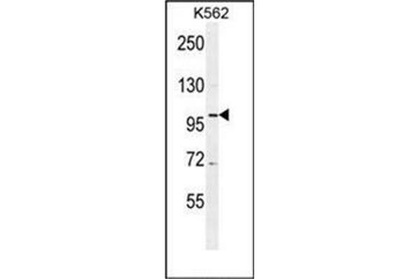 DDX27 antibody  (C-Term)