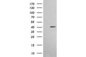 Western Blotting (WB) image for anti-Acetyl-CoA Acyltransferase 2 (ACAA2) antibody (ABIN1495723)